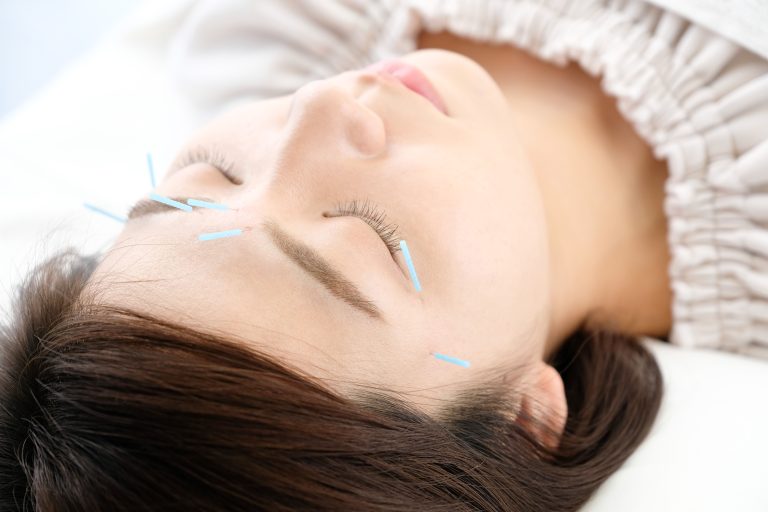 Facial Acupuncture: A Holistic Approach to Skincare with Weng’s Acupuncture & herbs Clinic of San Diego, CA
